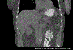 4D CT imaging showing just organs and no tumor, unlike the 4D PET-CT scan