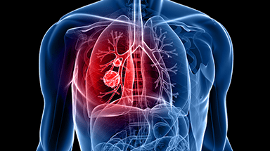 lung diagram callout