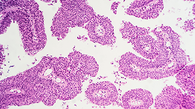 urologic cancer cell