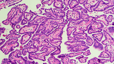 endocrine thyroid cell