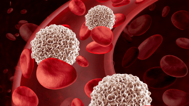 CAR T-Cell Therapy Clinical Trials at UPMC Hillman Cancer Center