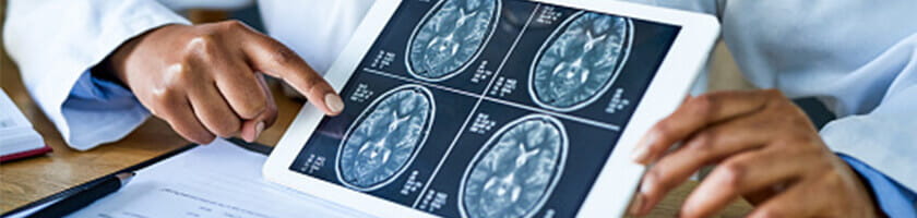 Brain Tumor Banner