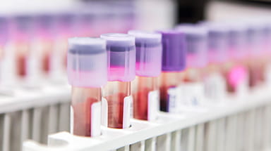 Cancer Research and Clinical Trials