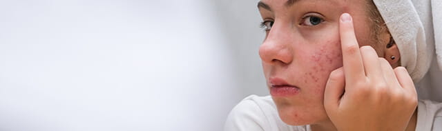 UPMC Children's Dermatology Services