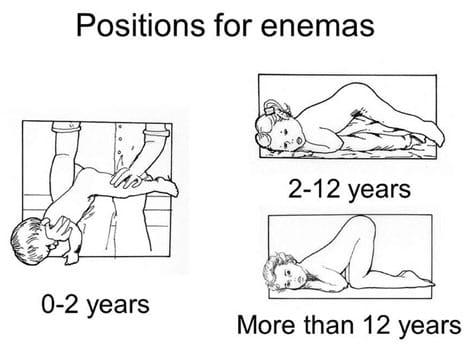 Positions for administering an enema