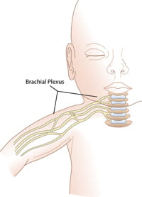Brachial Plexus illustration