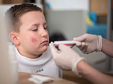 Boy getting treatment for a scar