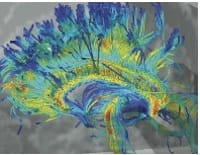 The Neuroimaging Research Program aims to develop new imaging technologies.