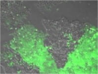 Cancer stem cells (green) illuminated with ultraviolet light. 