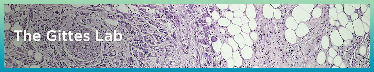 The Gittes Lab for Diabetes and Pancreatitis Research