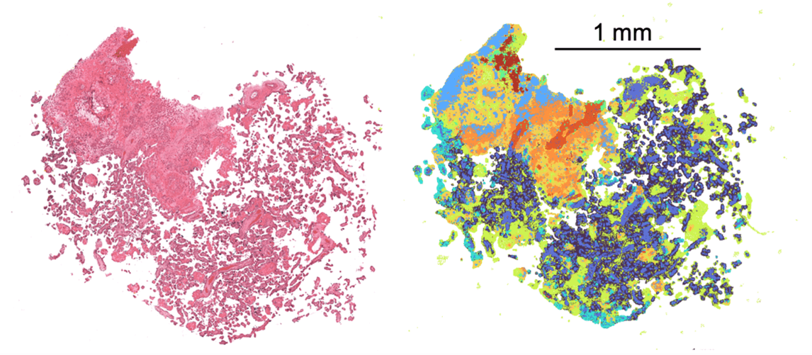 Placental health and prematurity