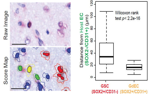 Representative images show the close proximity of GdEC (yellow) and host ECs (green) compared with GSCs (red).