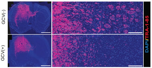Representative images for tumor appearance (left) and peritumoral satellite lesions (right) in PDX mouse model.