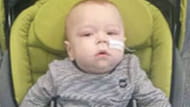 Learn more about Levi's experience with Krabbe Disease at Children's Hospital.