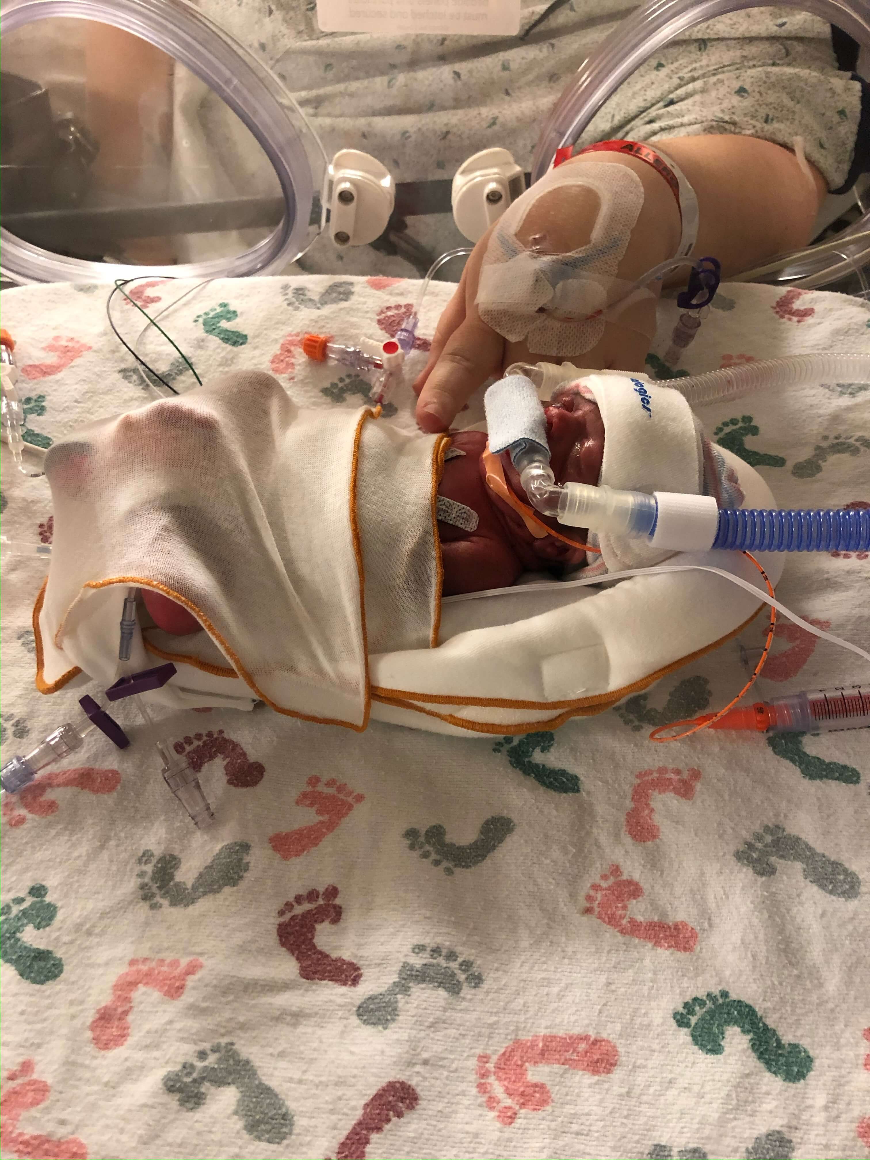 Leiana Rodgers as a newborn