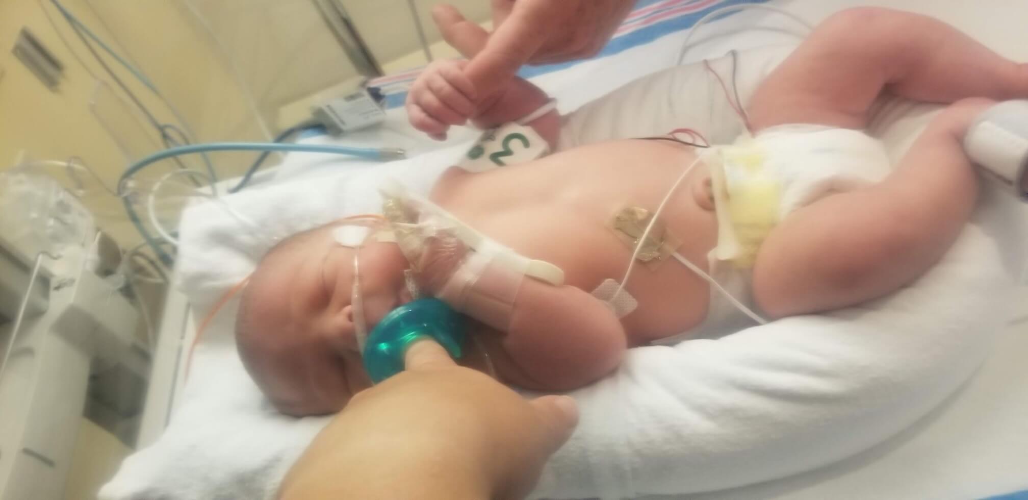 Jaxson Harris as a baby hooked up to a monitor