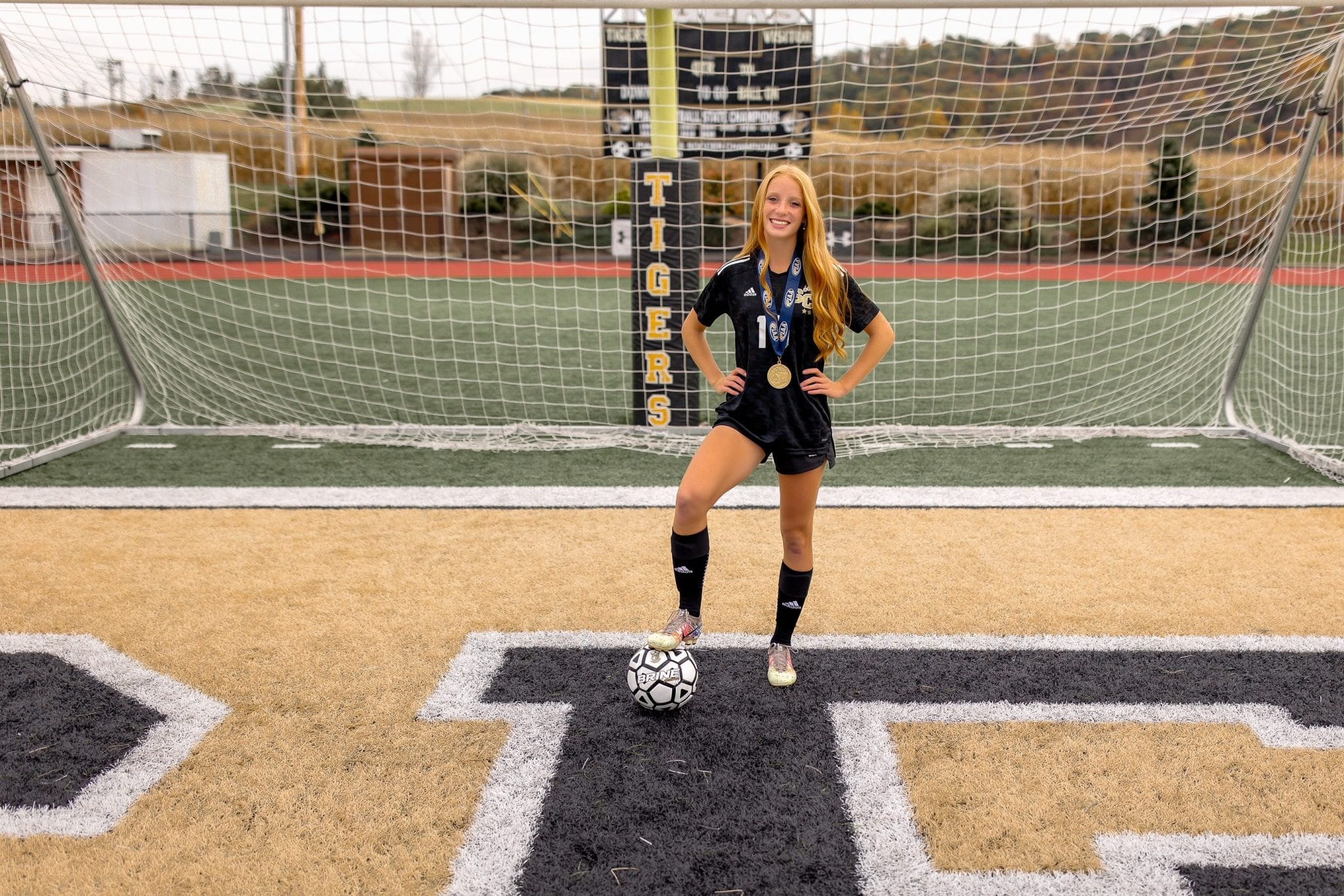 Cassidy’s Story: Compartment Syndrome