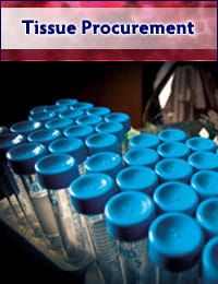 Tissue Procurement