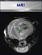 MRI image