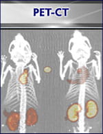 Image of pet-ct scan.