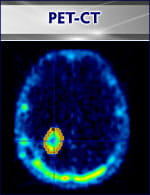 PET-CT image