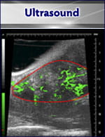 Ultrasound image