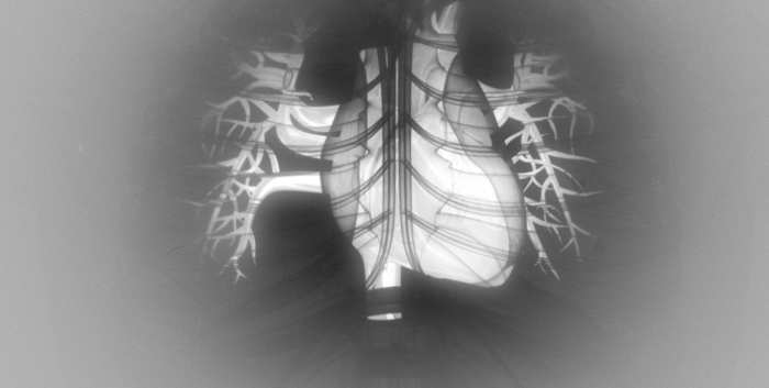 Advances in Cardiac Transplantation