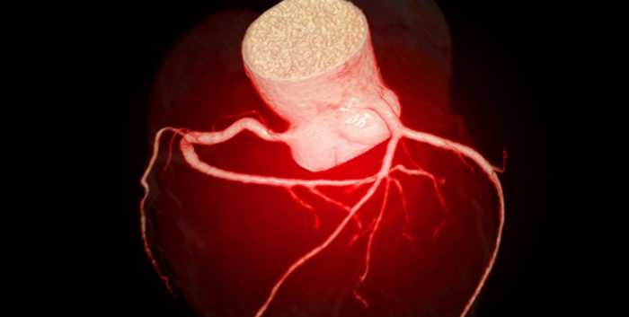 Asymptomatic Severe Coronary Disease: Detection to Decisions. Do We Know The Proper Management?