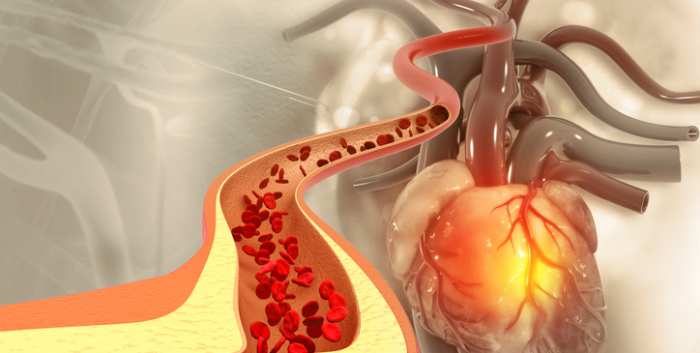 Changing Concepts in International Cardiology Over the Last Four Decades