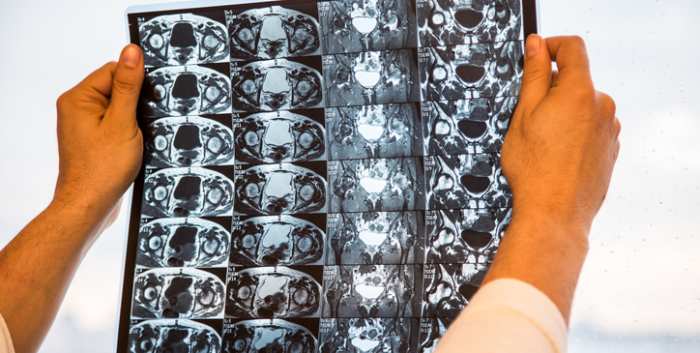 Comprehensive Hip Health Current Concepts in Diagnosis Imaging and Management of Articular Cartilage