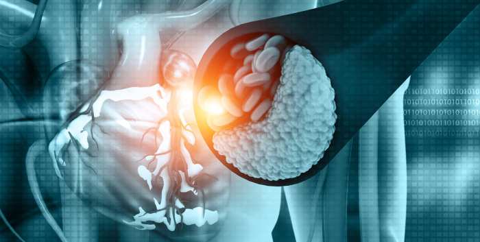 Diagnostic Testing In Coronary Artery Disease