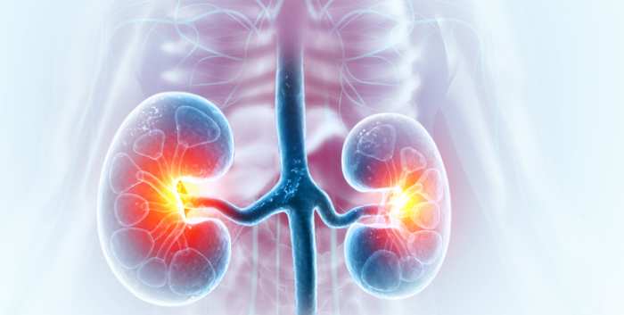 Kidney Transplant Symposium