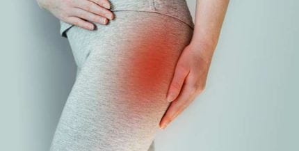 Pains in a Butt An Physiatric Approach to Buttock Pain
