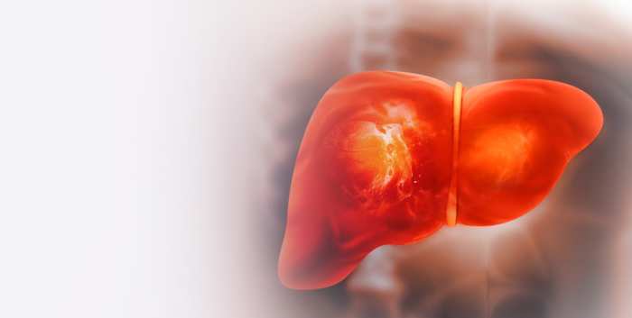 Transplantation Grand Rounds Intrahepatic Cholangiocarcinoma