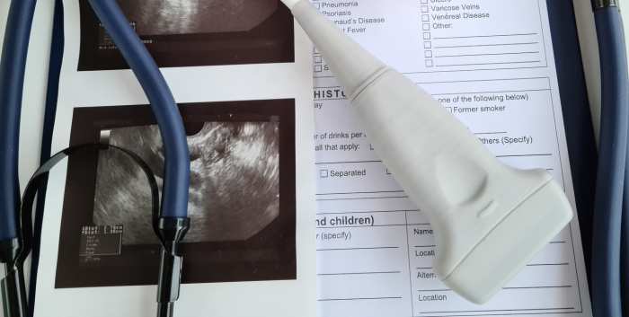 Ultrasound Planning The Use of Transperineal Ultrasound for Mode of Delivery after Prior Complicated