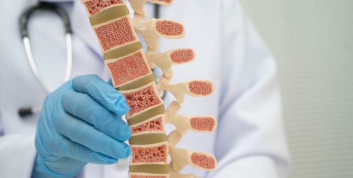 Updates in Osteoporosis Management