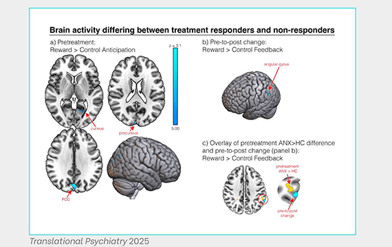Brain activity differing between treatment responders and non-responders.