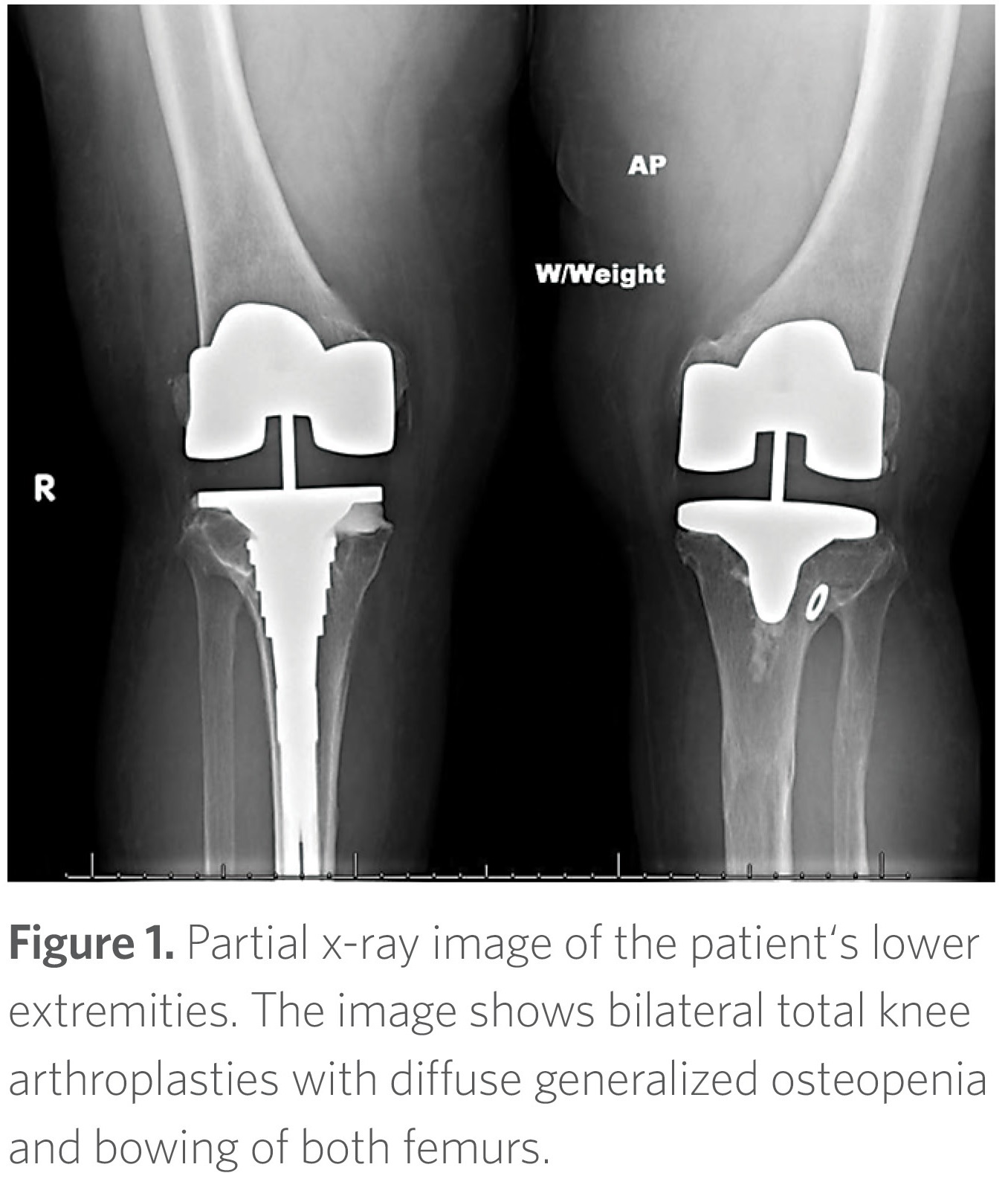 Endo Spring 2019 Figure 1
