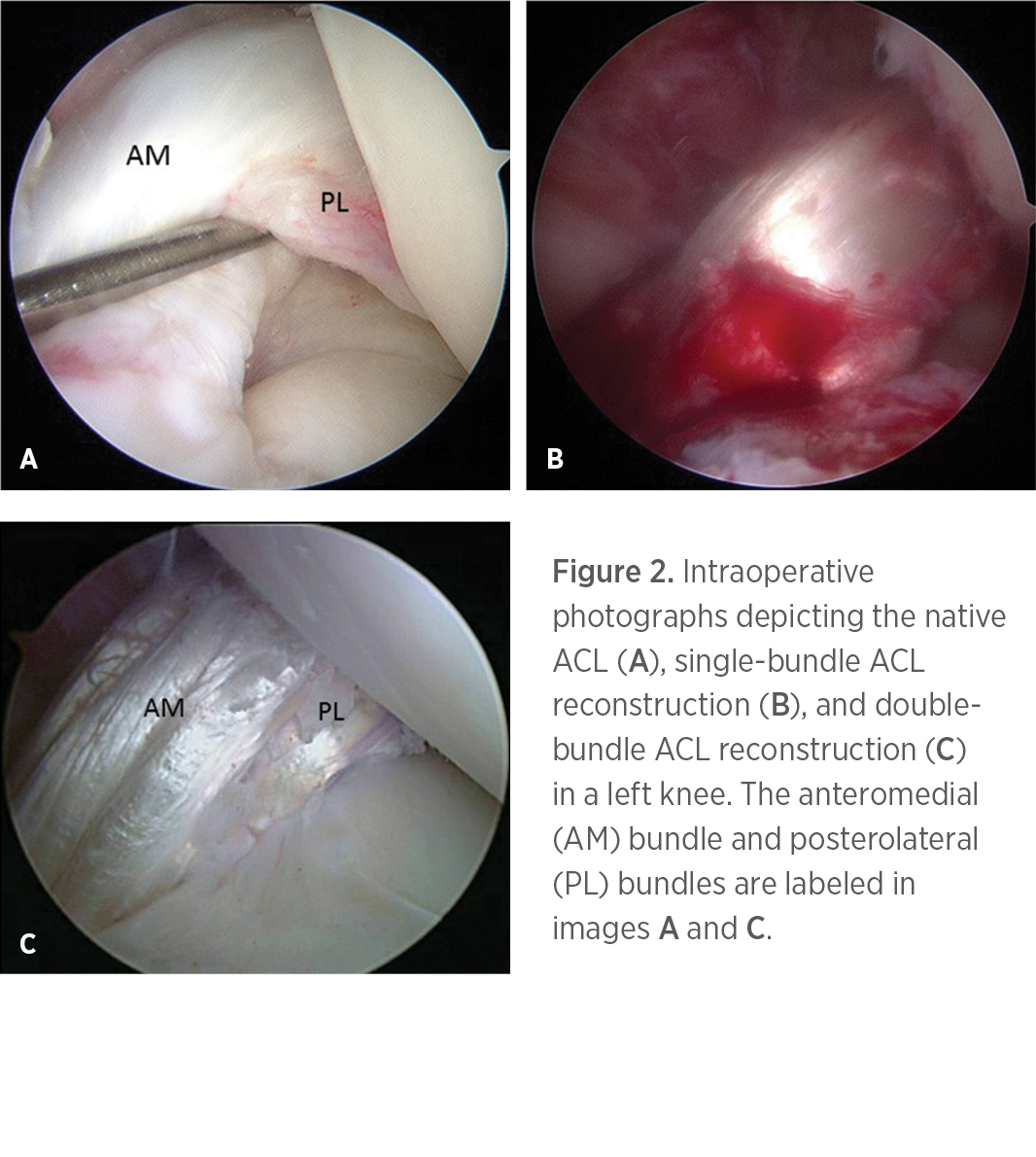 Figure 2. Intraoperative photos