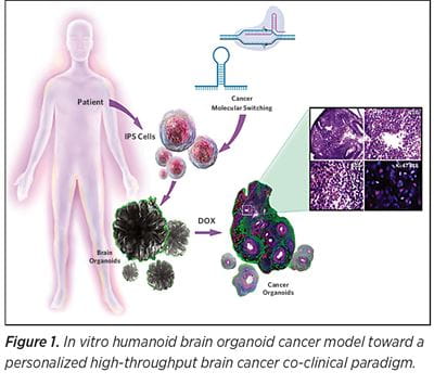 In vitro humanoid brain organoid cancer model toward a personalized high-throughput brain cancer co-clinical paradigm.