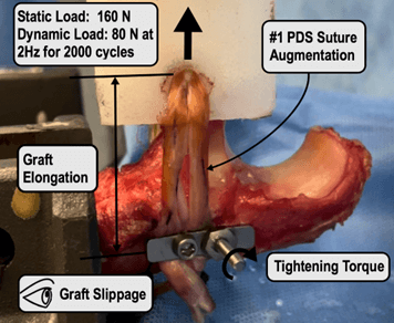 Biomechanical testing of ligament reconstruction demonstrated no slipping of graft under plate during static and dynamic testing.