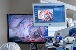 During surgery image.