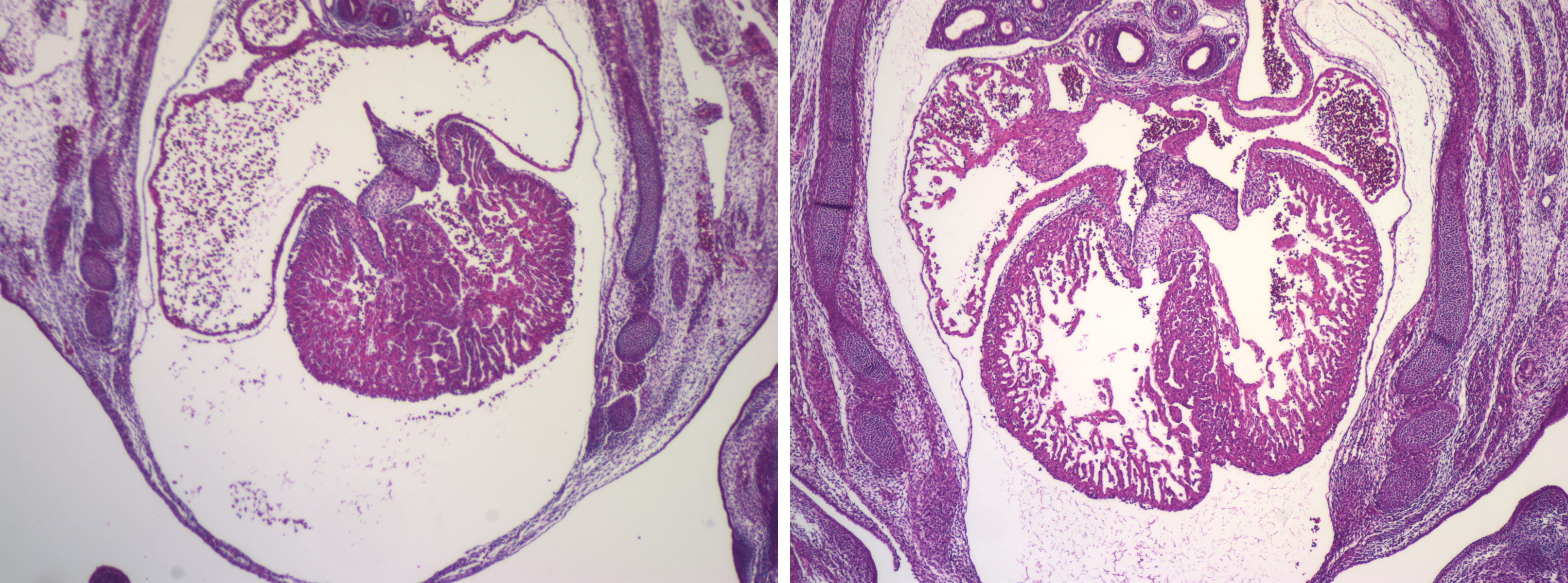 Hearts of two mouse embryos that share the same mutation. 