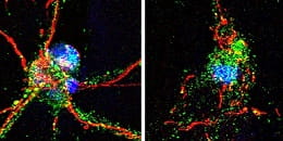 Mouse nerve cells with intact axons (left) and damaged axons (right). 