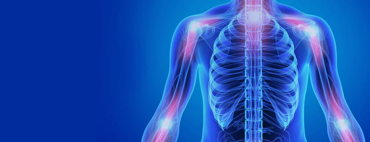UPMC Physician Resources Rheumatology Image of Human Torso Highlighting Joints