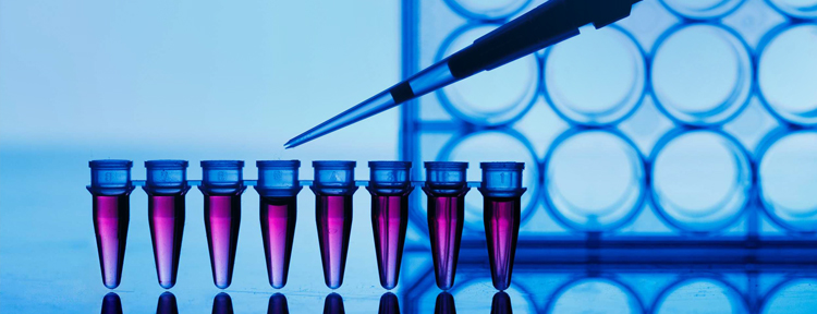 UPMC Physician Resources Urology Photo Blood in Test Tubes