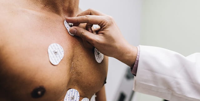 Heart Failure Q&A with Gavin Hickey, MD