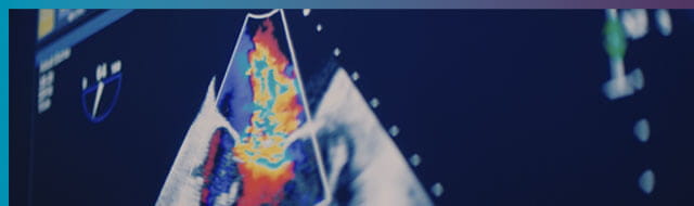 Dr. Arvind Hoskoppal, Cardiologist