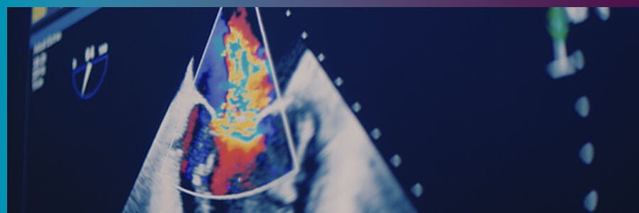 Dr. Arvind Hoskoppal, Cardiologist