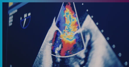 Dr. Arvind Hoskoppal, Cardiologist